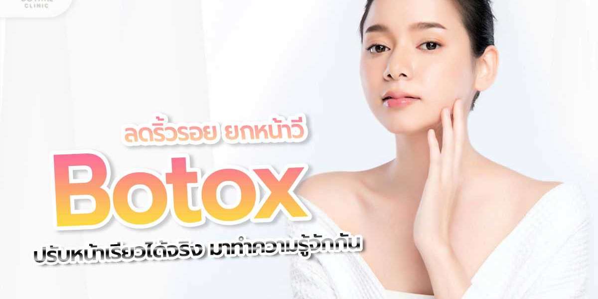 Botox reduz rugas