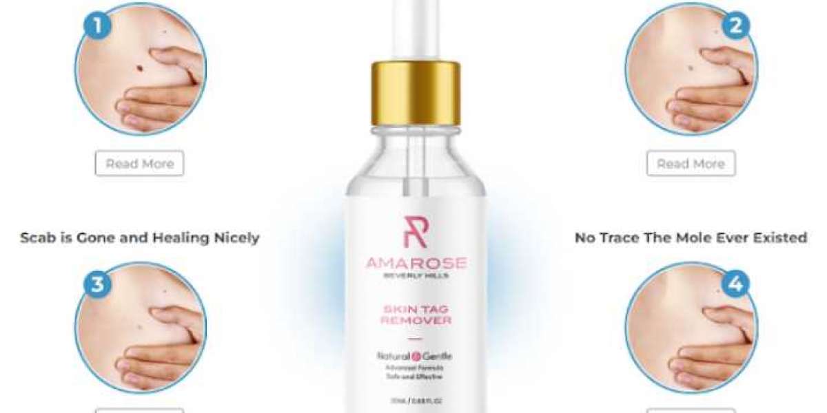 Amarose Skin Tag Remover Reviews - Reducing All Anti-Agin Skin Issues! Read Reviews & Cost
