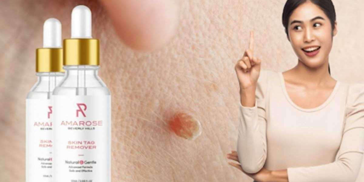 When Is the Best Time to Use an Amaroose Skin Tag Remover?
