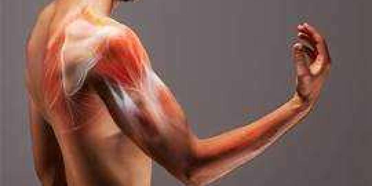Bicep tendonitis: What you need to know