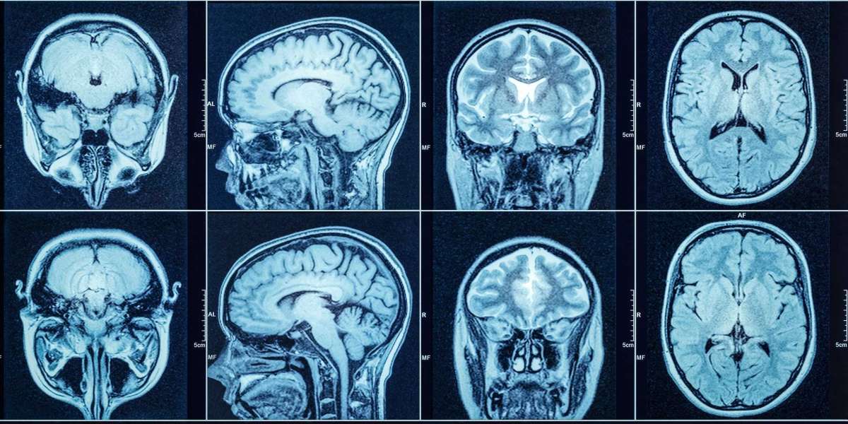 Unveiling the Mysterious Abnormality The Brain Scan Honolulu Chronicles