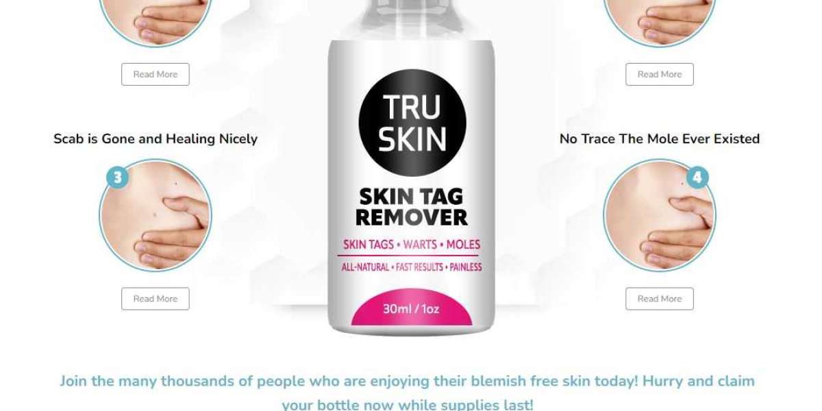 Tru Skin Tag Remover USA: How Does It Work to Bid Farewell to Skin Tags?