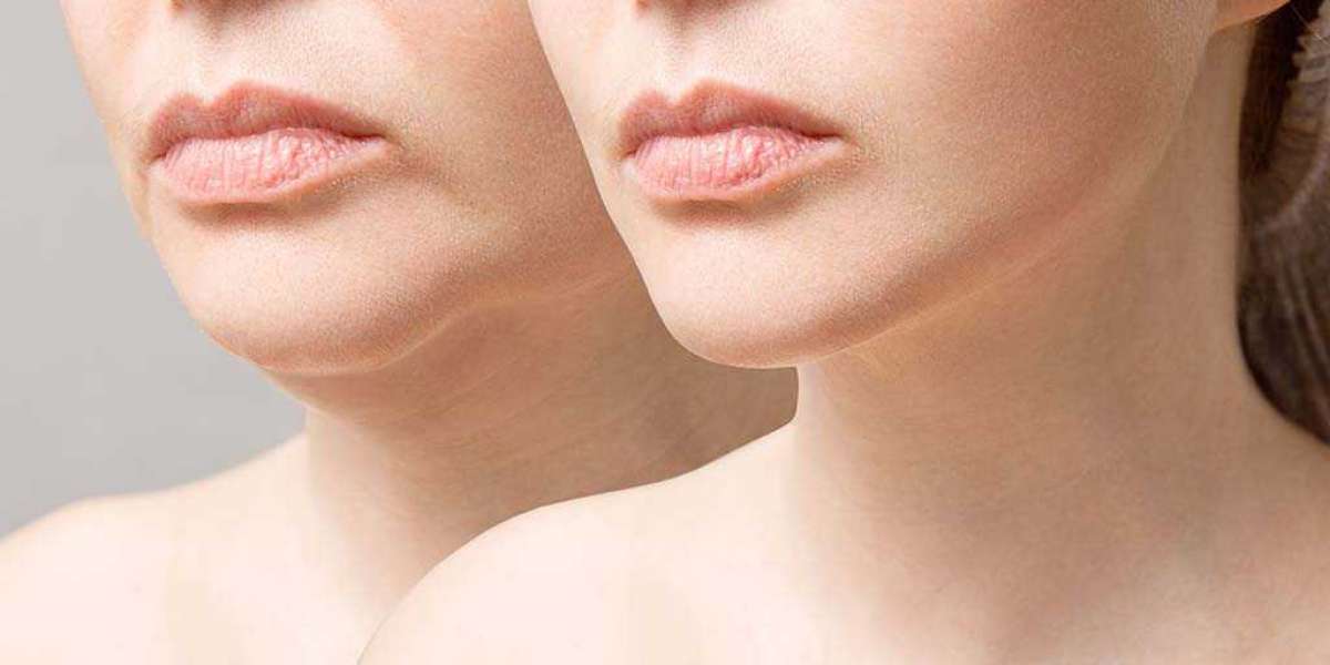 How Facial Plastic Surgery Could Boost Your Self-Confidence