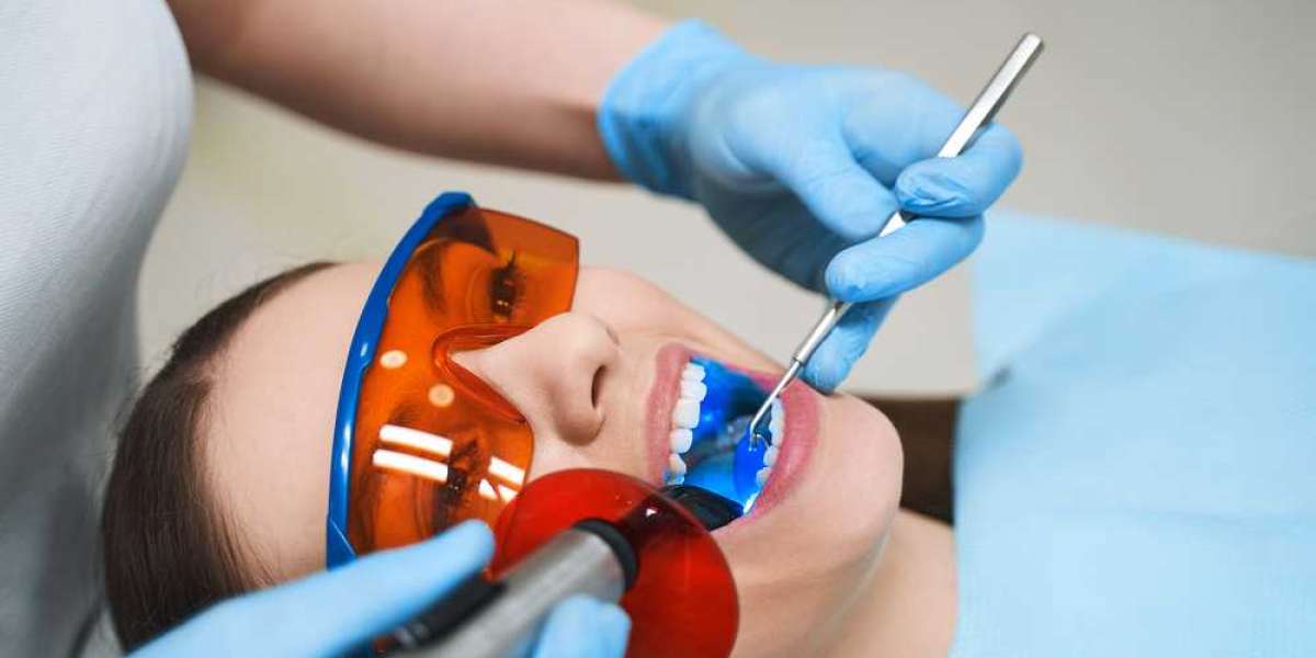 Teeth Whitening in Windsor: Brightening Your Smile
