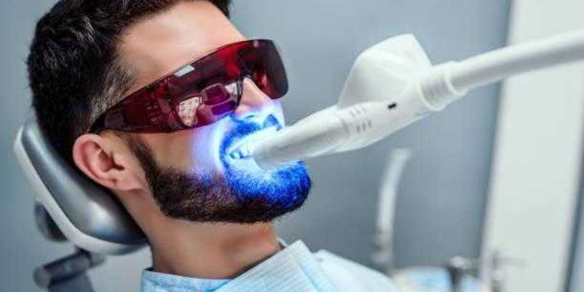A Comprehensive Guide to Teeth Whitening in Toronto