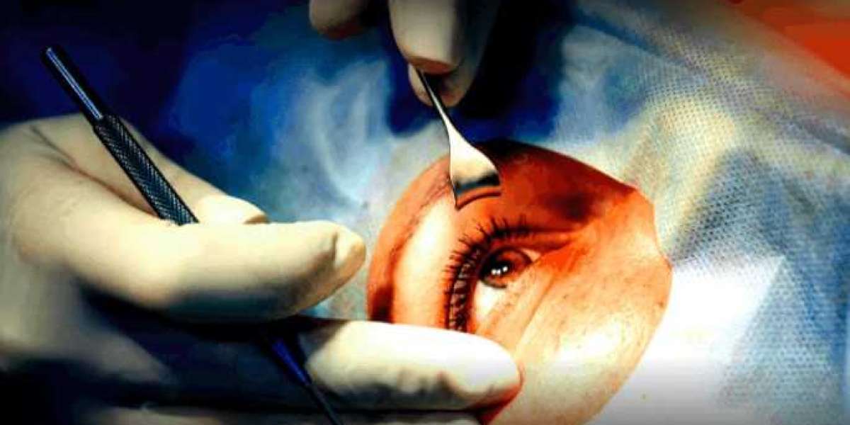 Cataract Surgical Devices Market Global Key Players, Industry Size by 2026