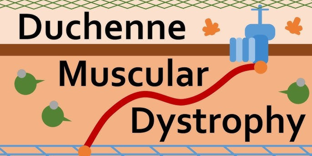 Duchenne Muscular Dystrophy: Insights into Genetic Puzzles and Solutions