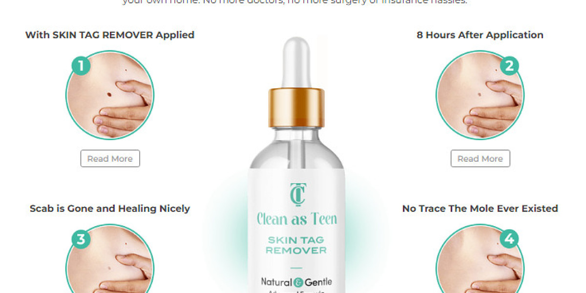 Clean as Teen Skin Tag Remover Serum Reviews 2024 & Official Website In USA