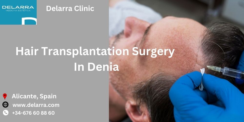 Conquer Hair Loss: Unraveling The Secrets To The Best Hair Transplant Surgery In Denia | LinkedDirectory