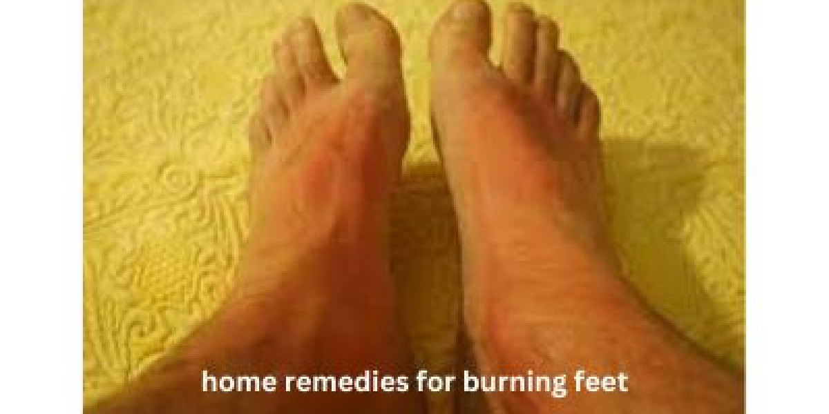 Soothing the Burn: Effective Home Remedies for Burning Feet