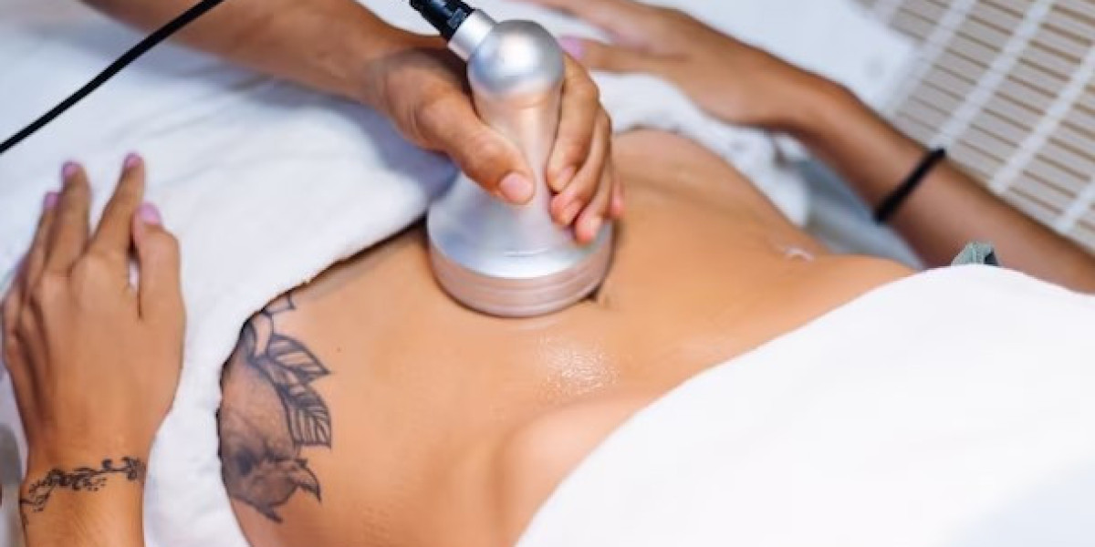 Emsculpt Before and After: Revealing Transformative Body Toning