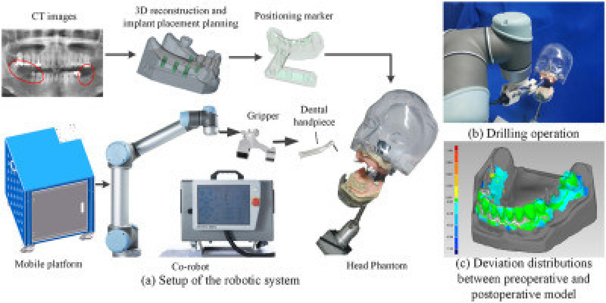 Robotic Dentistry Market Size, Share Analysis, Key Companies, and Forecast To 2030
