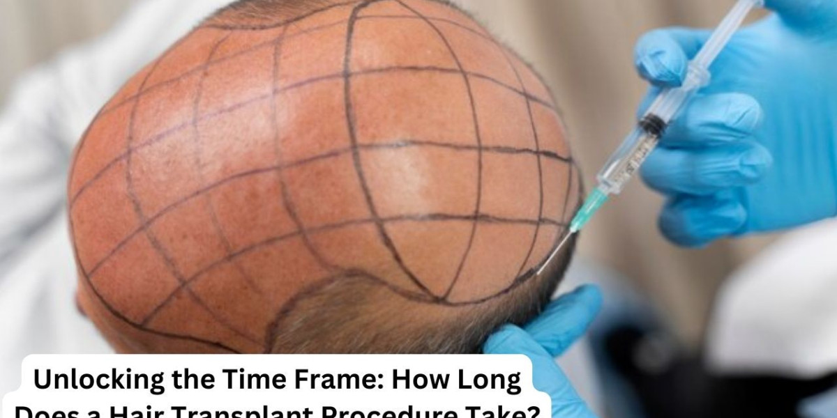 Unlocking the Time Frame: How Long Does a Hair Transplant Procedure Take?