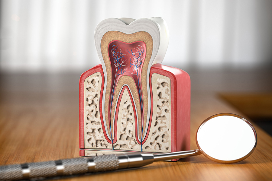 Root Canal Treatment in Mumbai | Single Visit Root Canal Treatment Dental Clinic