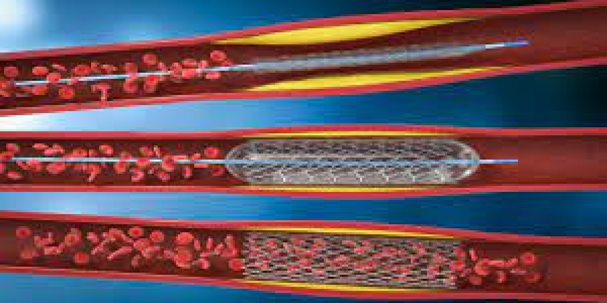 Vascular Grafts Market Size, Growth, Price Trends, Report 2024-2032