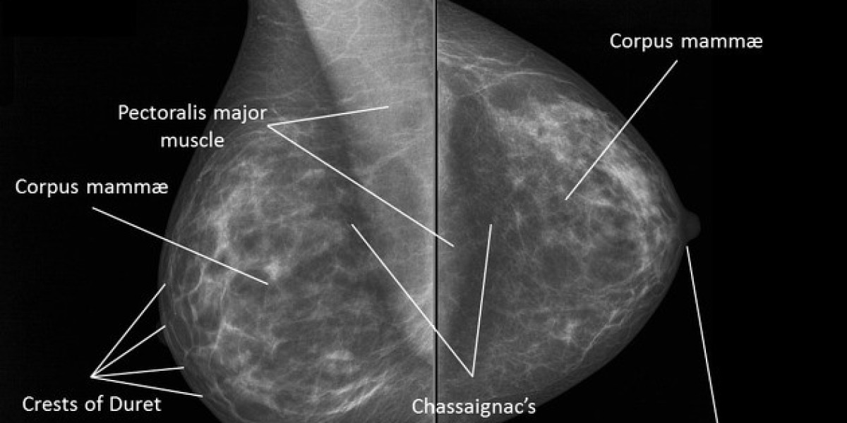 Mammography Market is Anticipated to Register 12.3% CAGR through 2031